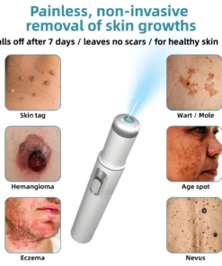 KIDSNEED® Non-invasive Mole & Wart Removal Laser Pen