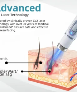 KIDSNEED® Non-invasive Mole & Wart Removal Laser Pen