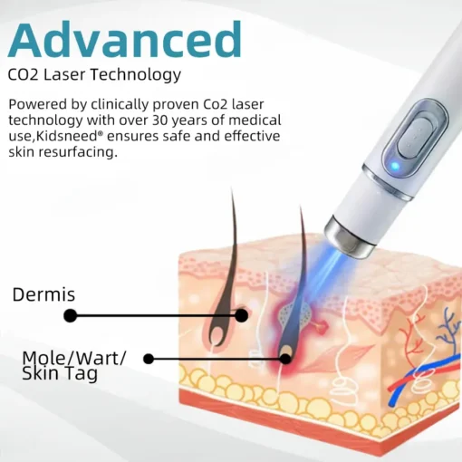 KIDSNEED® Non-invasive Mole & Wart Removal Laser Pen
